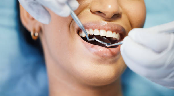 Best After-Hours Emergency Dentist in Pine City, MN