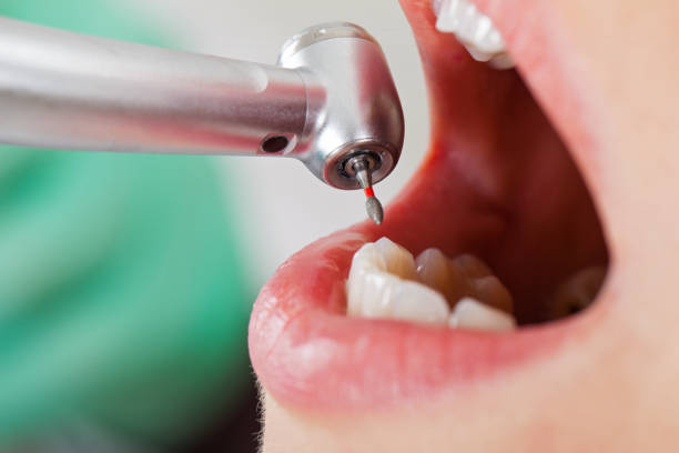 Best Weekend Emergency Dentist in Pine City, MN